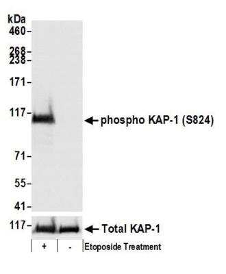 Western Blot: KAP1 [p Ser824] Antibody [NB100-2350]